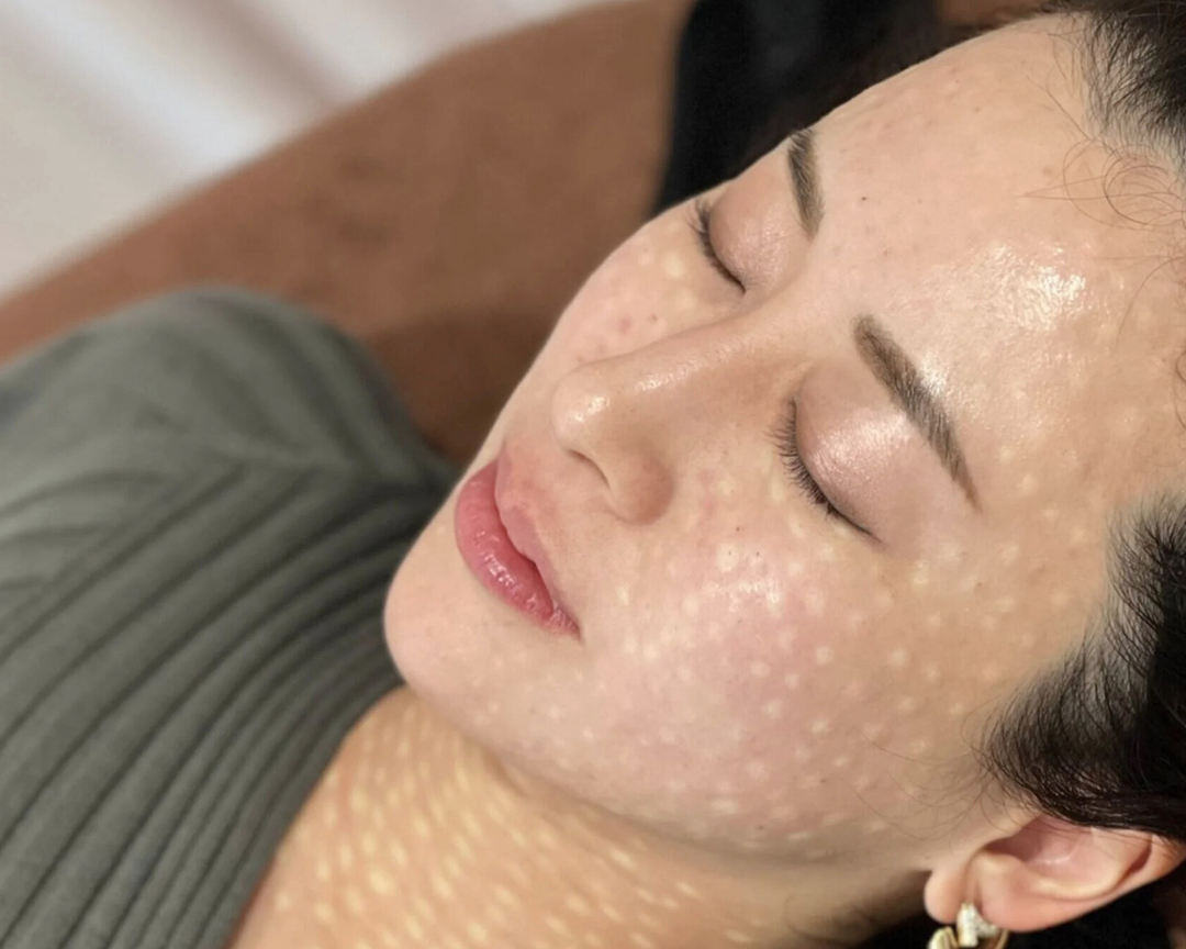 ハイドロブースト（スキンブースター）とは